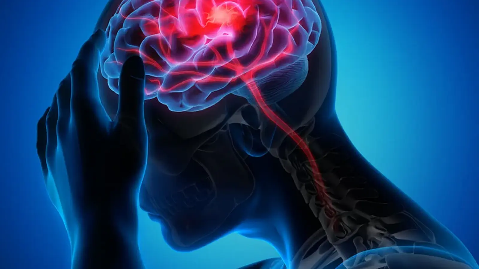 هوش مصنوعی خطر ژنتیکی سکته مغزی را پیش بینی می کند