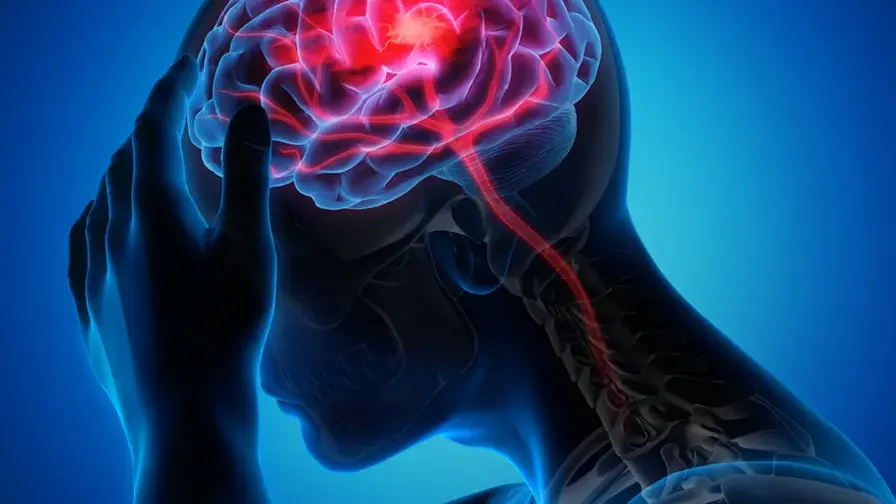 هوش مصنوعی خطر ژنتیکی سکته مغزی را پیش بینی می کند